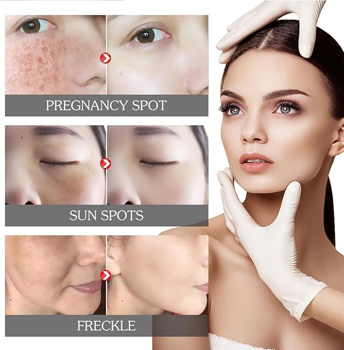 Eelhoe - Pigment Correcting Cream