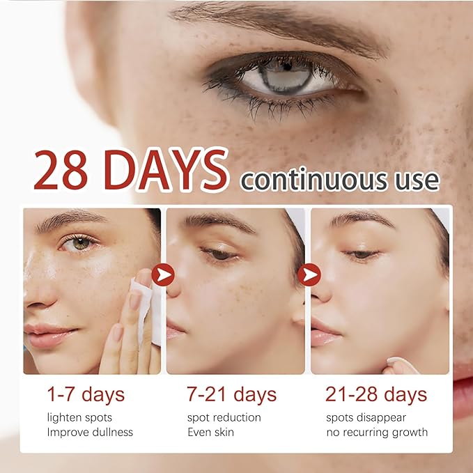 Eelhoe - Pigment Correcting Cream